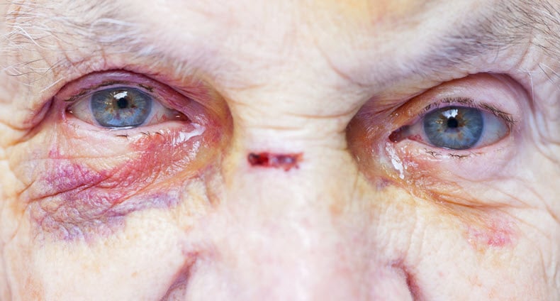 California Elder Abuse Lawyers